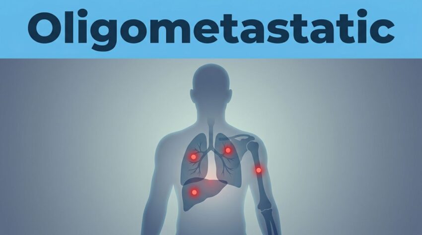 Oligometastatic Cancer Explained in Plain English